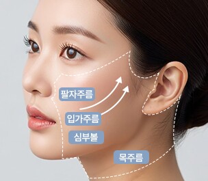 Retaining ligament and SMAS dissection — nasolabial folds, mouth-corner wrinkles, deep cheeks, neck wrinkles