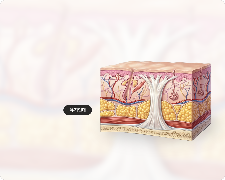 Releasing the retaining ligaments that hold the skin tightly — retaining ligaments