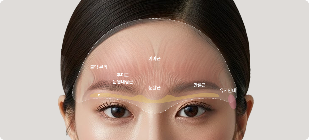 How a forehead lift works — frontalis · procerus · corrugator / depressor supercilii · periosteal release · orbicularis oculi · retaining ligaments
