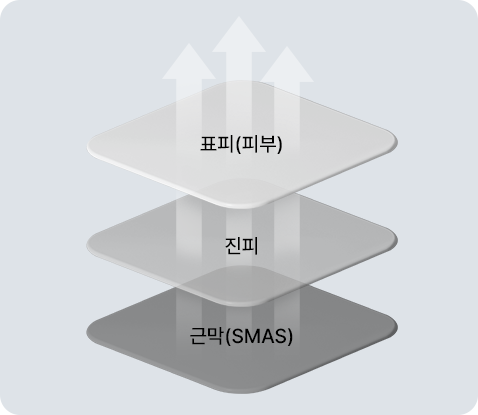 Layer-customized 3-step lifting — epidermis (skin) · dermis · fascia (SMAS)