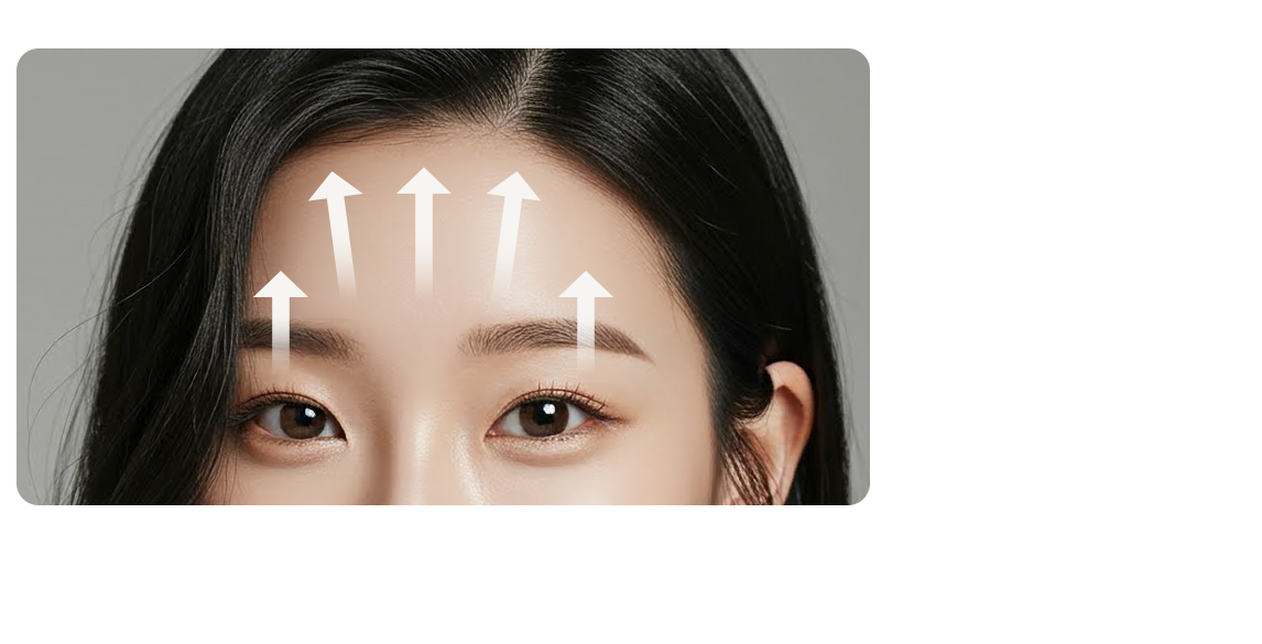 Forehead lifting direction