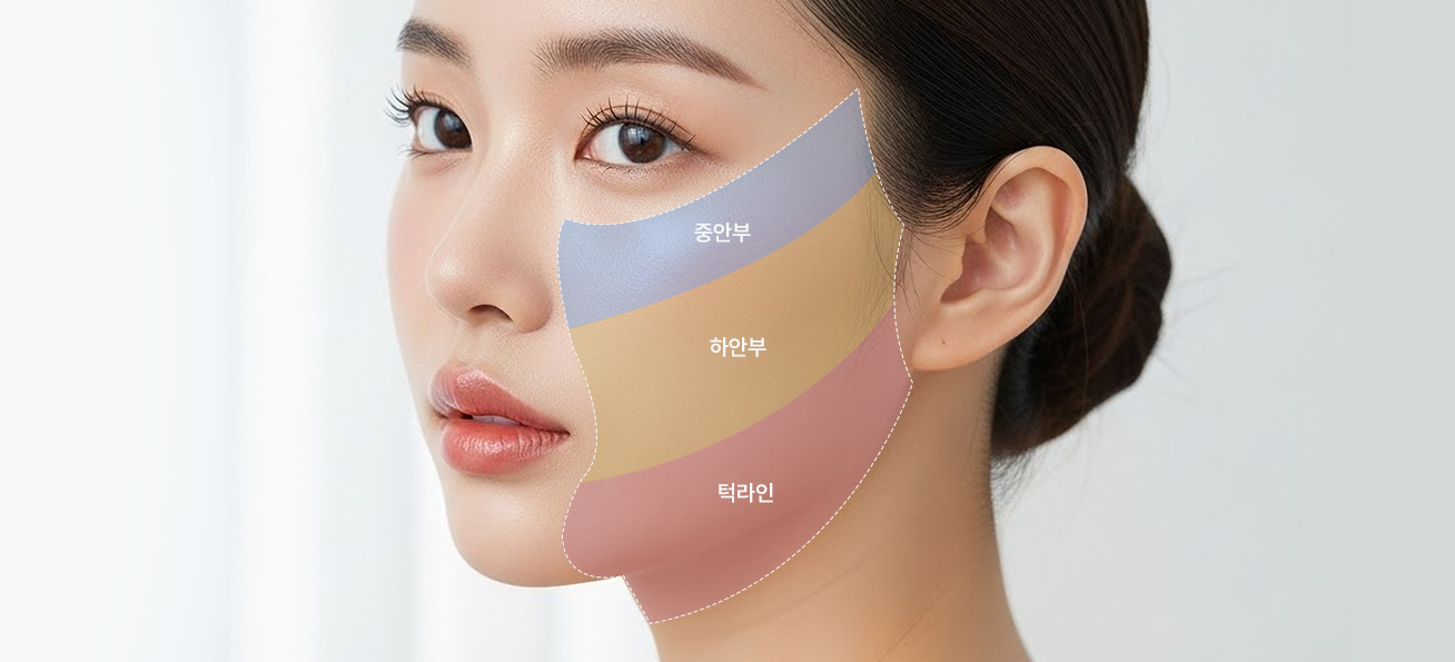 Mid-to-lower face lifting area (midface, lower face, jawline)