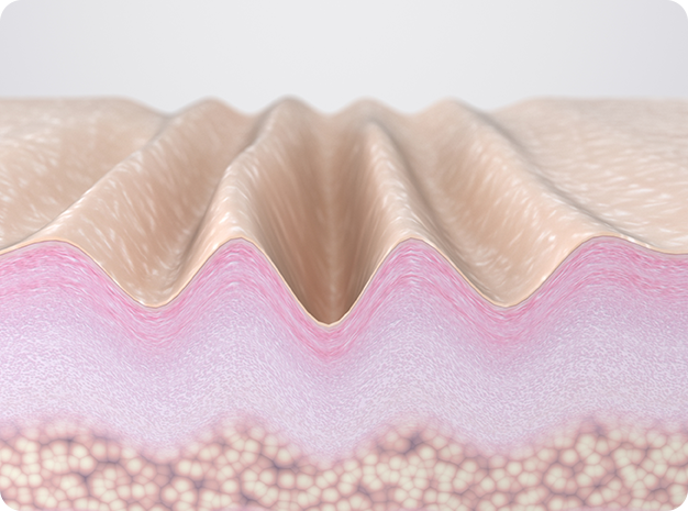 Wrinkled skin layer