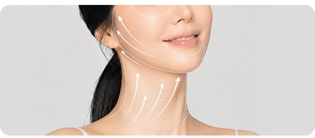 Neck Lift + Facelift