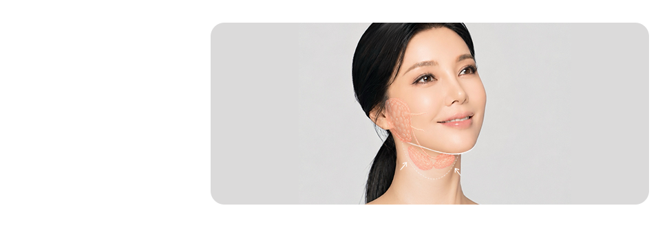Neck Lift + Toad Neck Correction