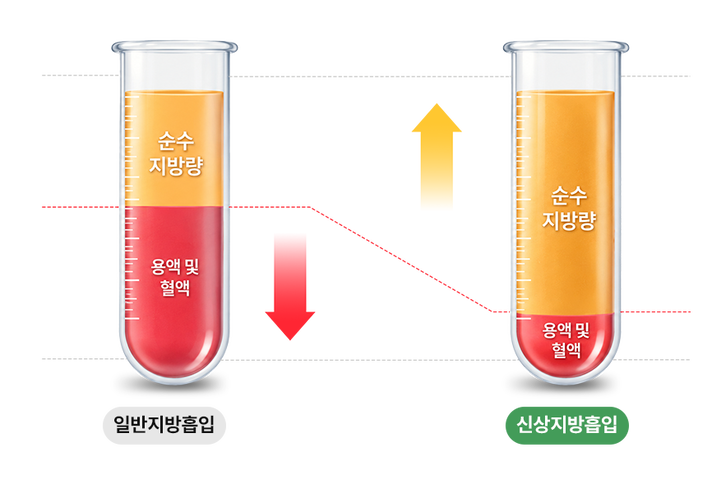 Comparison of pure fat volume: standard liposuction vs SINSANG liposuction