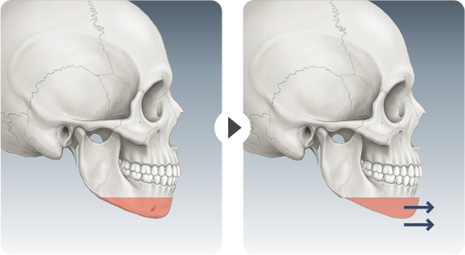 CASE 03 surgical steps
