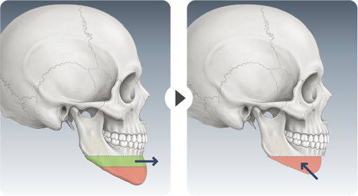CASE 04 surgical steps