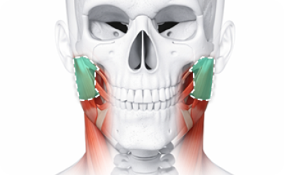 Masseter Reduction