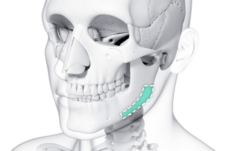 Cortical Bone Resection