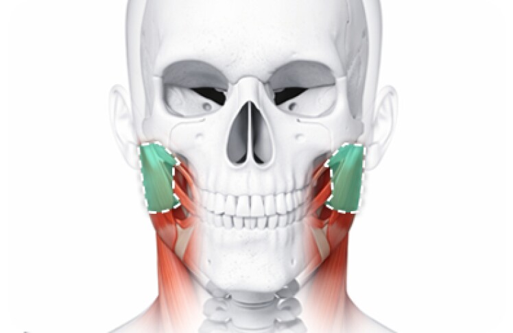 Masseter Reduction