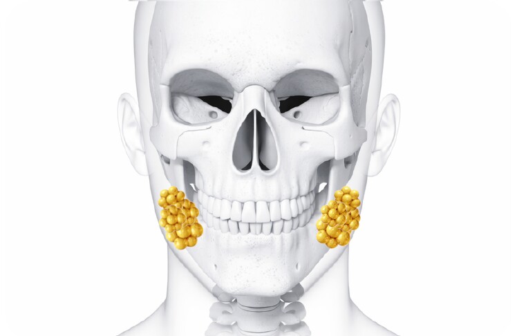 Buccal Fat Removal