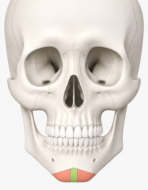 Case 01 step 1