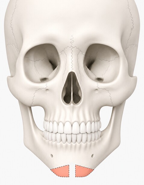 Case 01 step 2