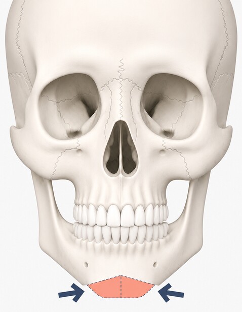 Case 01 step 3