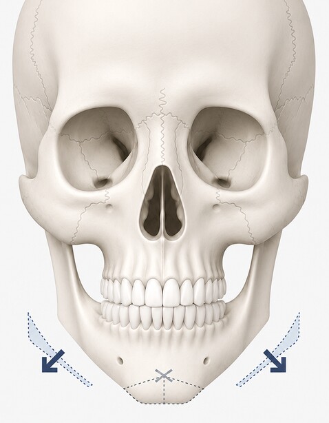 Case 01 step 4