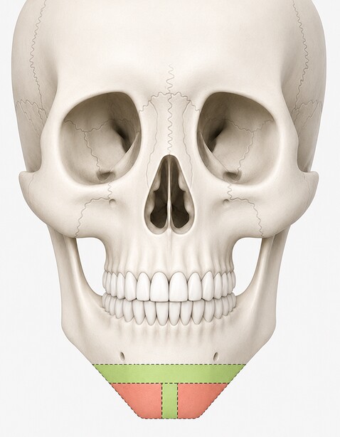 Case 02 step 1
