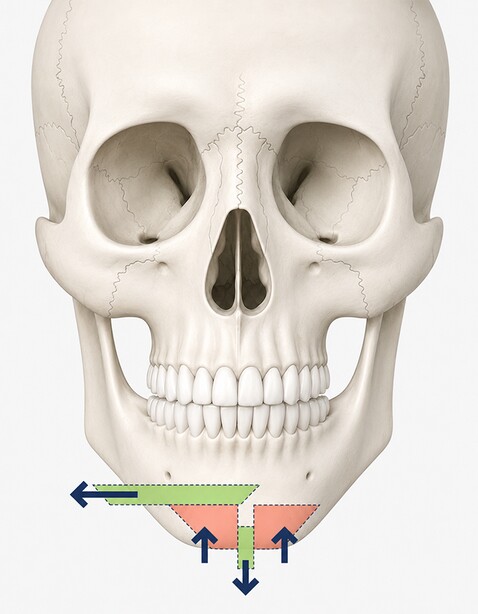 Case 02 step 2