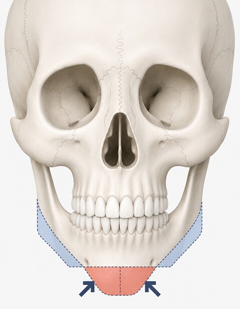 Case 02 step 3