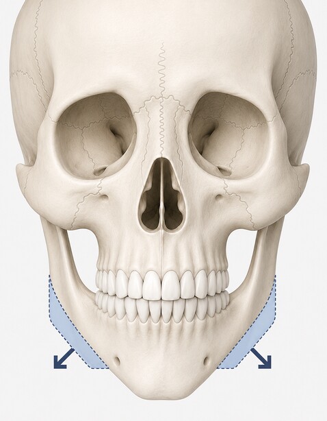Case 02 step 4