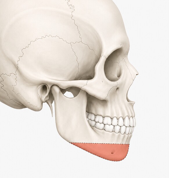 Case 03 step 1