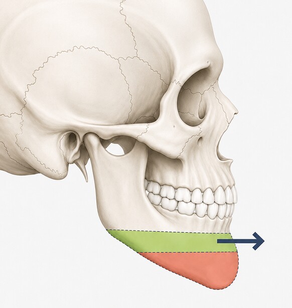Case 04 step 1