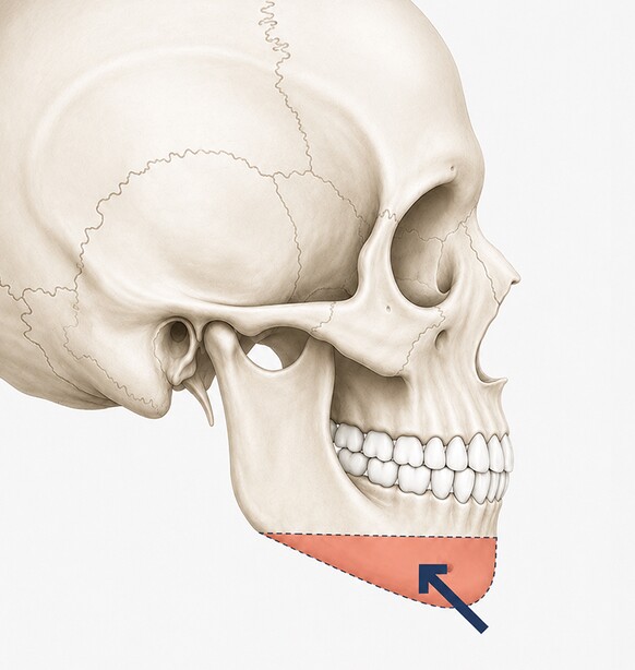 Case 04 step 2