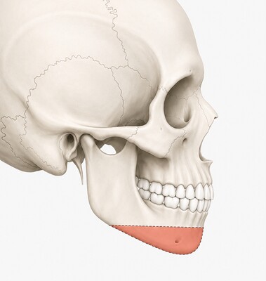 Case 03 step 1