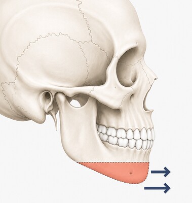 Case 03 step 2