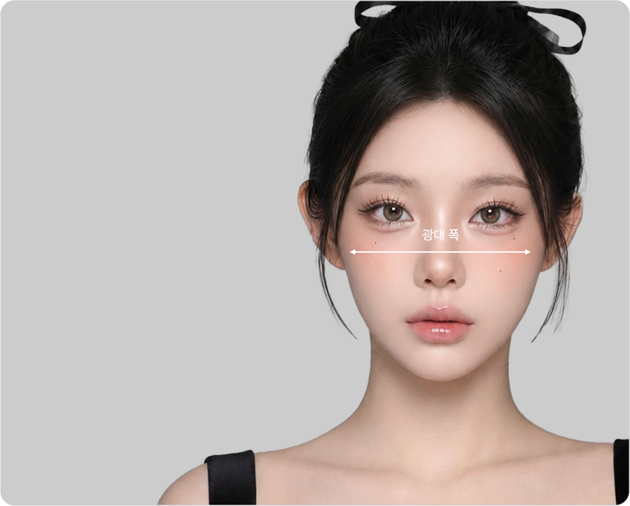 Improving cheekbone width, the reason your face looks big (cheekbone width shown)