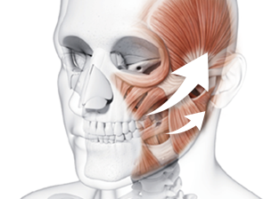 Sagging-Prevention Fascial Fixation