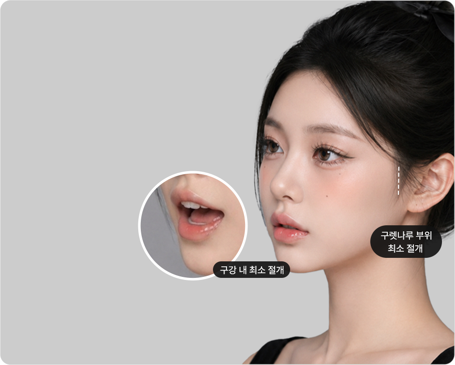 Minimal incision at the sideburn area, minimal incision inside the mouth