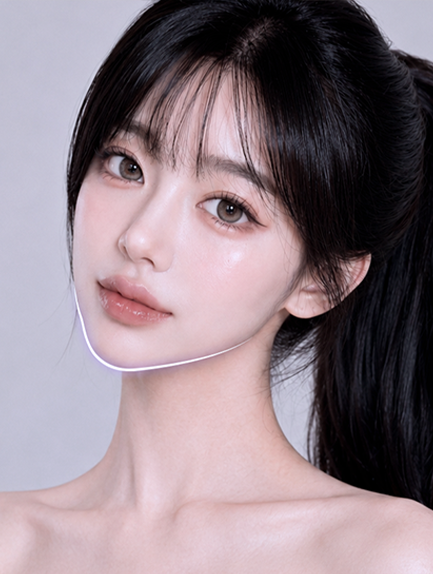 SINSANG Double Chin Revision