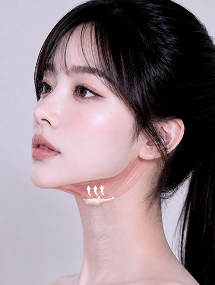 Hyoid correction