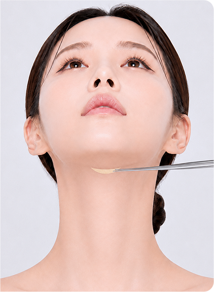 Excision of stretched skin