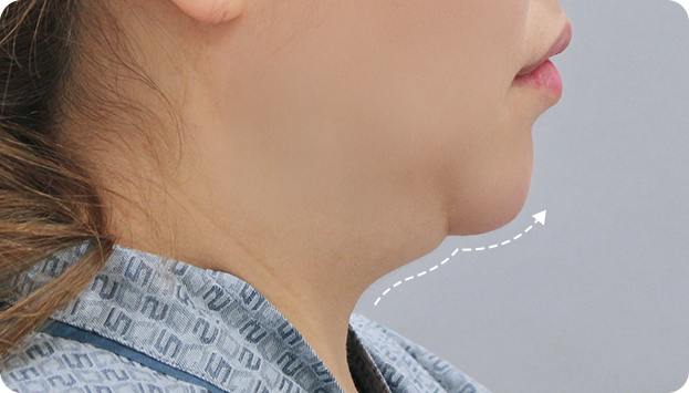 When the border between the neck and face is unclear