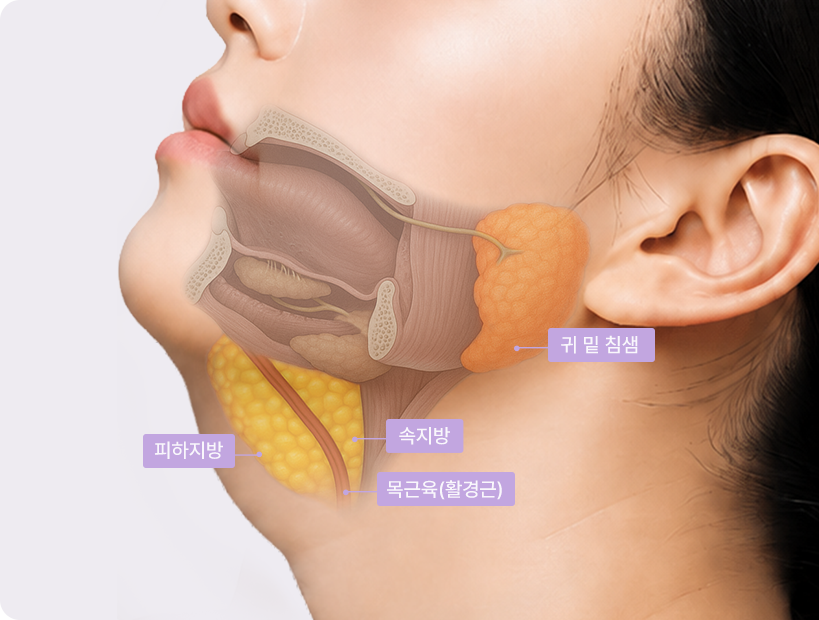 Toad Neck stage 3 cross-section — parotid gland highlighted