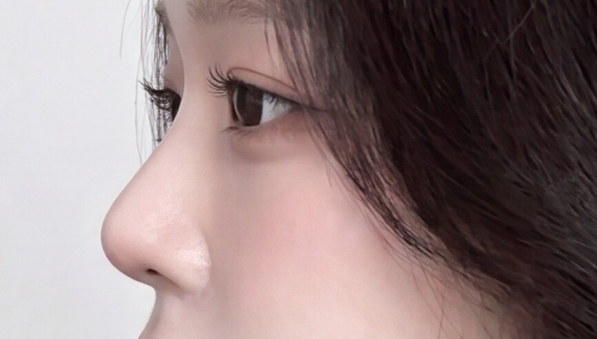 A natural line from any angle
