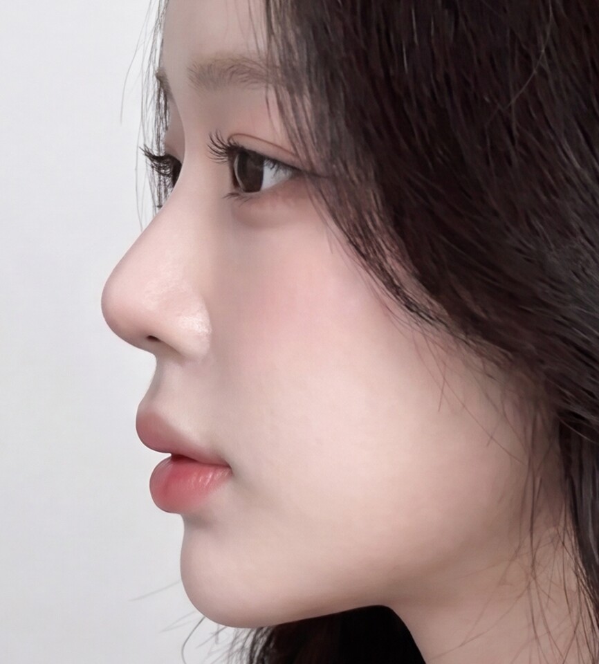A natural line from any angle
