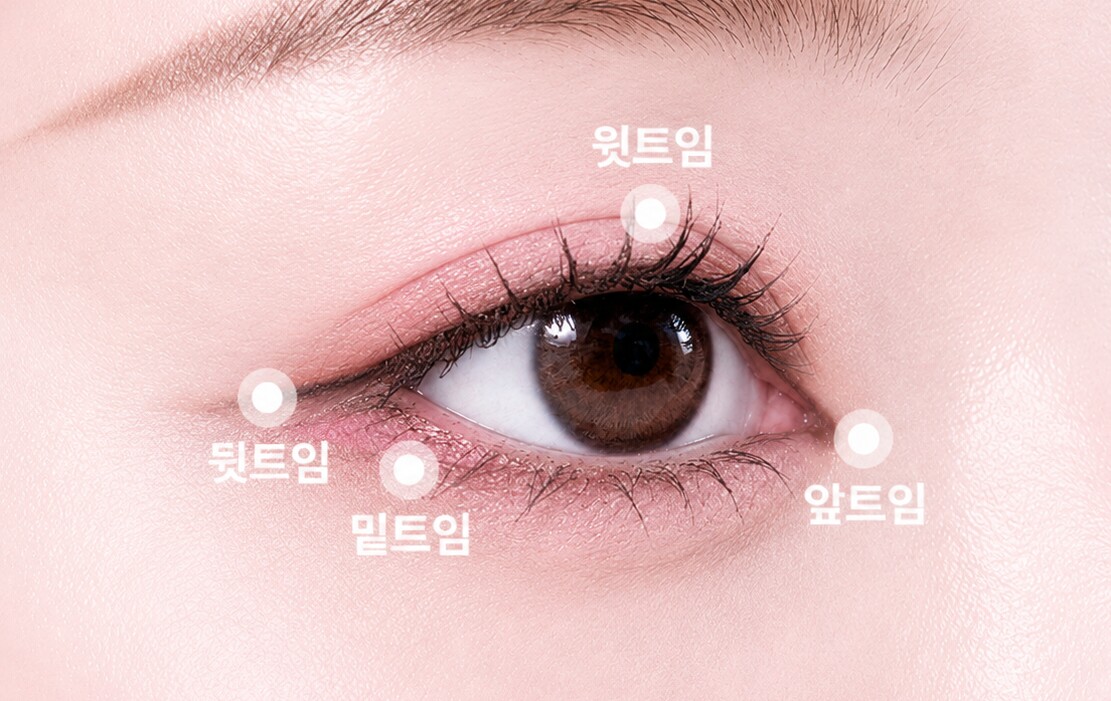 Canthoplasty areas — upper · lateral · lower · medial