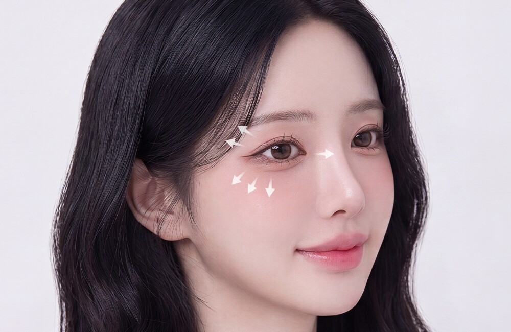 4-way canthoplasty synergy