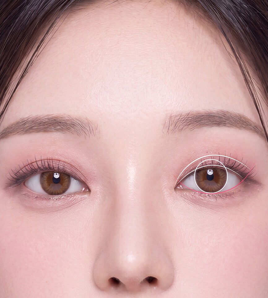 The golden time for successful eye revision