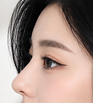 CASE 01 Glamorous straight line