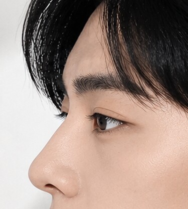 CASE 03 Masculine straight line