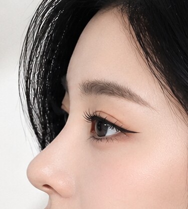 CASE 04 Natural-glam scooped line