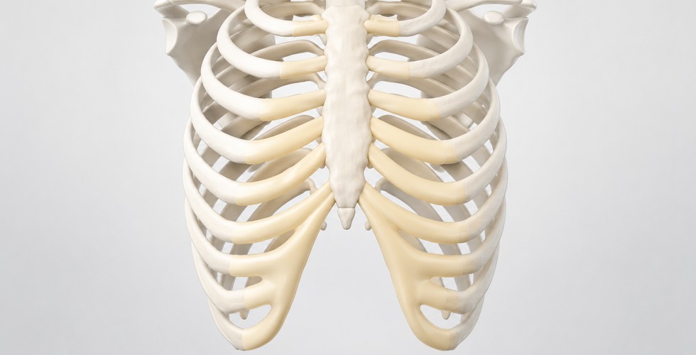Autologous Rib Cartilage
