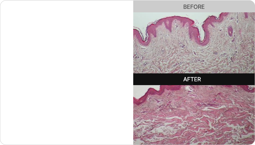 BEFORE AFTER skin tissue comparison