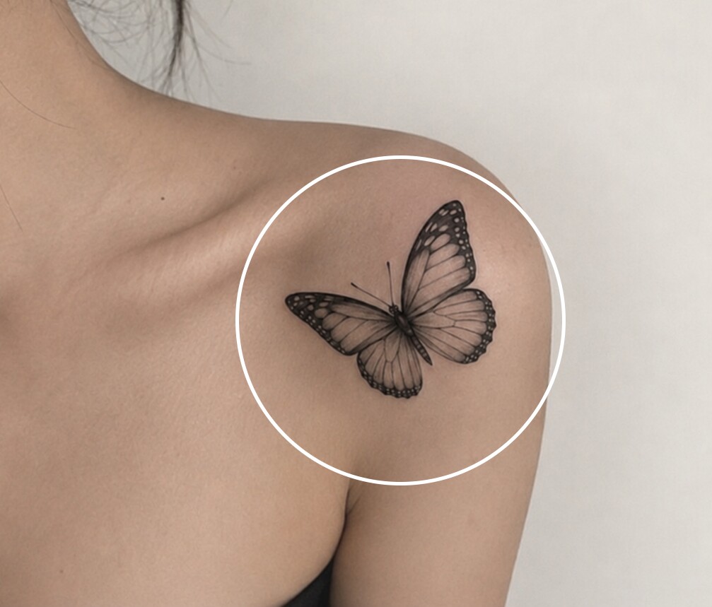 SINSANG Tattoo Removal