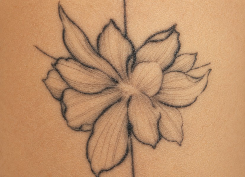 Black tattoo before treatment