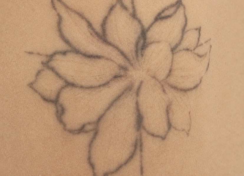 Black tattoo 1 week after the 1st session